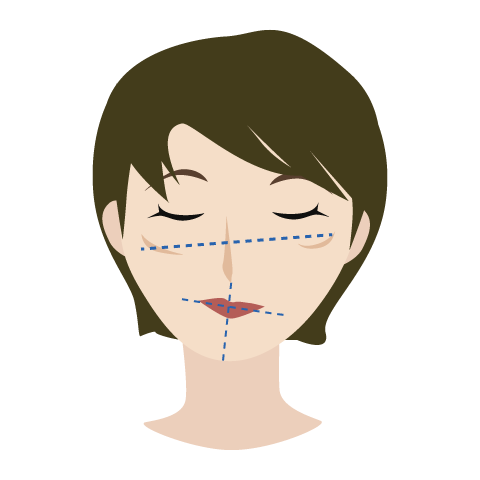 顔が左右非対称