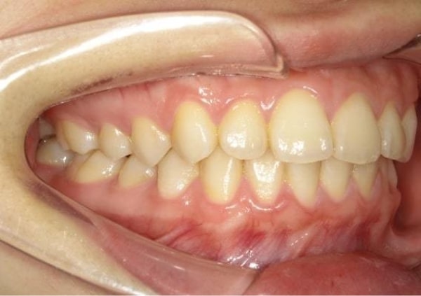 撮影のポイントの右写真