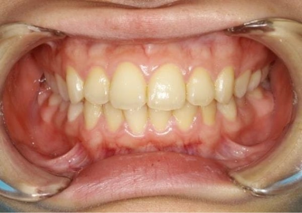 撮影のポイントの正面写真