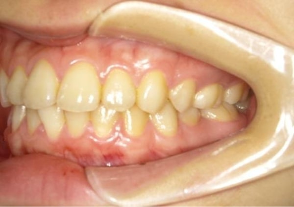 撮影のポイントの左写真