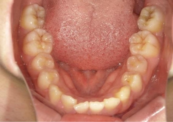 撮影のポイントの上写真