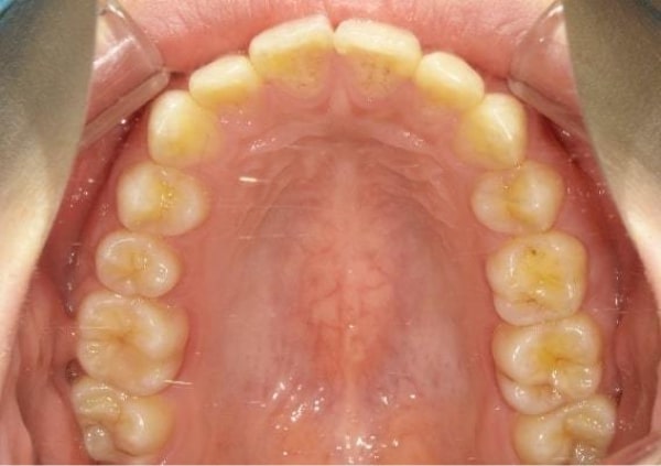 撮影のポイントの下写真